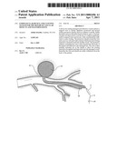 Endovascular device and clotting system for the repair of vascular defects and malformations diagram and image