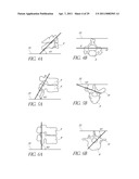 VERTEBRAL FACET JOINT PROSTHESIS AND METHOD OF FIXATION diagram and image