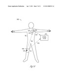 TRANSCUTANEOUS NEUROSTIMULATOR FOR TREATING HYPERTENSION diagram and image