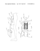 Ultrasound-enhanced stenosis therapy diagram and image