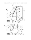 Double loop auto-adjust pet restraint device diagram and image