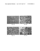 COLLOIDAL PLANT POWDER/EXTRACT ENCAPSULATION WITH PECTIN-PROTEIN COACERVATE GELS diagram and image