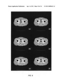 Radiation therapy inverse treatment planning using a regularization of sparse segments diagram and image