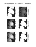 METHOD FOR IDENTIFYING A TOOTH REGION diagram and image