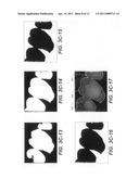 METHOD FOR IDENTIFYING A TOOTH REGION diagram and image