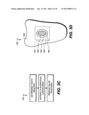 METHOD FOR EXTRACTING A CARIOUS LESION AREA diagram and image