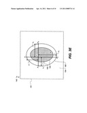 METHOD FOR EXTRACTING A CARIOUS LESION AREA diagram and image