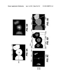 METHOD FOR EXTRACTING A CARIOUS LESION AREA diagram and image