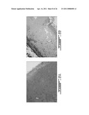 COMPOSITION AND METHOD FOR THE REPAIR AND REGENERATION OF CARTILAGE AND OTHER TISSUES diagram and image