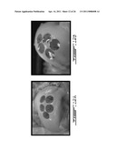 COMPOSITION AND METHOD FOR THE REPAIR AND REGENERATION OF CARTILAGE AND OTHER TISSUES diagram and image