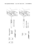 COMPOSITION AND METHOD FOR THE REPAIR AND REGENERATION OF CARTILAGE AND OTHER TISSUES diagram and image