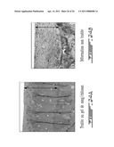 COMPOSITION AND METHOD FOR THE REPAIR AND REGENERATION OF CARTILAGE AND OTHER TISSUES diagram and image