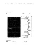 Proliferation Signatures and Prognosis for Gastrointestinal Cancer diagram and image