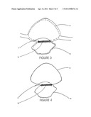 Novelty eye patch with artificial eye or eyelid diagram and image