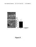 Compositions and Methods for Treating Neurodegenerating Diseases diagram and image