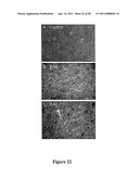 Compositions and Methods for Treating Neurodegenerating Diseases diagram and image