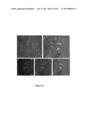 Compositions and Methods for Treating Neurodegenerating Diseases diagram and image