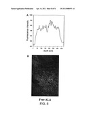 Esters of 5-aminolevulinic acid as photosensitizing agents in photochemotherapy diagram and image