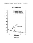 Esters of 5-aminolevulinic acid as photosensitizing agents in photochemotherapy diagram and image