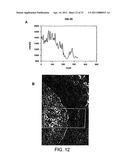 Esters of 5-aminolevulinic acid as photosensitizing agents in photochemotherapy diagram and image