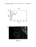 Esters of 5-aminolevulinic acid as photosensitizing agents in photochemotherapy diagram and image