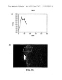 Esters of 5-aminolevulinic acid as photosensitizing agents in photochemotherapy diagram and image