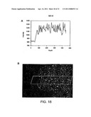 Esters of 5-aminolevulinic acid as photosensitizing agents in photochemotherapy diagram and image