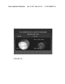 Esters of 5-aminolevulinic acid as photosensitizing agents in photochemotherapy diagram and image