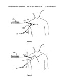 Method for Monitoring or Treating Nervous System Disorders diagram and image