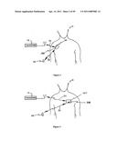 Method for Monitoring or Treating Nervous System Disorders diagram and image