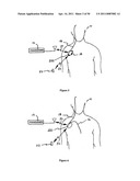 Method for Monitoring or Treating Nervous System Disorders diagram and image