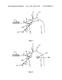 Method for Monitoring or Treating Nervous System Disorders diagram and image