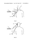 Method for Monitoring or Treating Nervous System Disorders diagram and image