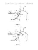 Method for Monitoring or Treating Nervous System Disorders diagram and image