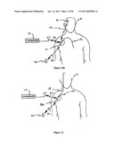 Method for Monitoring or Treating Nervous System Disorders diagram and image