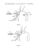 Method for Monitoring or Treating Nervous System Disorders diagram and image