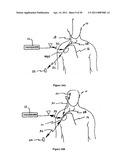 Method for Monitoring or Treating Nervous System Disorders diagram and image