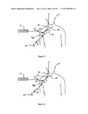 Method for Monitoring or Treating Nervous System Disorders diagram and image