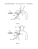 Method for Monitoring or Treating Nervous System Disorders diagram and image