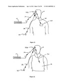 Method for Monitoring or Treating Nervous System Disorders diagram and image