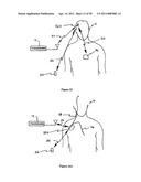 Method for Monitoring or Treating Nervous System Disorders diagram and image