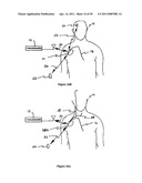 Method for Monitoring or Treating Nervous System Disorders diagram and image