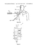 Method for Monitoring or Treating Nervous System Disorders diagram and image