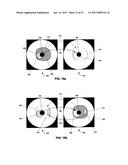 INTRAVASCULAR ULTRASOUND SYSTEM FOR CO-REGISTERED IMAGING diagram and image