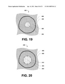 INTRAVASCULAR ULTRASOUND SYSTEM FOR CO-REGISTERED IMAGING diagram and image