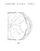 OCULAR PRESSURE REGULATION diagram and image