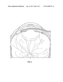 OCULAR PRESSURE REGULATION diagram and image