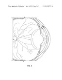 OCULAR PRESSURE REGULATION diagram and image