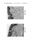 APPARATUS AND METHOD FOR ADJUSTABLE FRACTIONAL OPTICAL DERMATOLOGICAL TREATMENT diagram and image