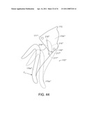 SURGICAL INSTRUMENT COMPRISING FIRST AND SECOND DRIVE SYSTEMS ACTUATABLE BY A COMMON TRIGGER MECHANISM diagram and image